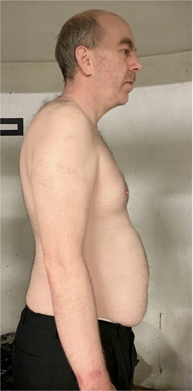Adam: before and after transformation with Strategic Gains