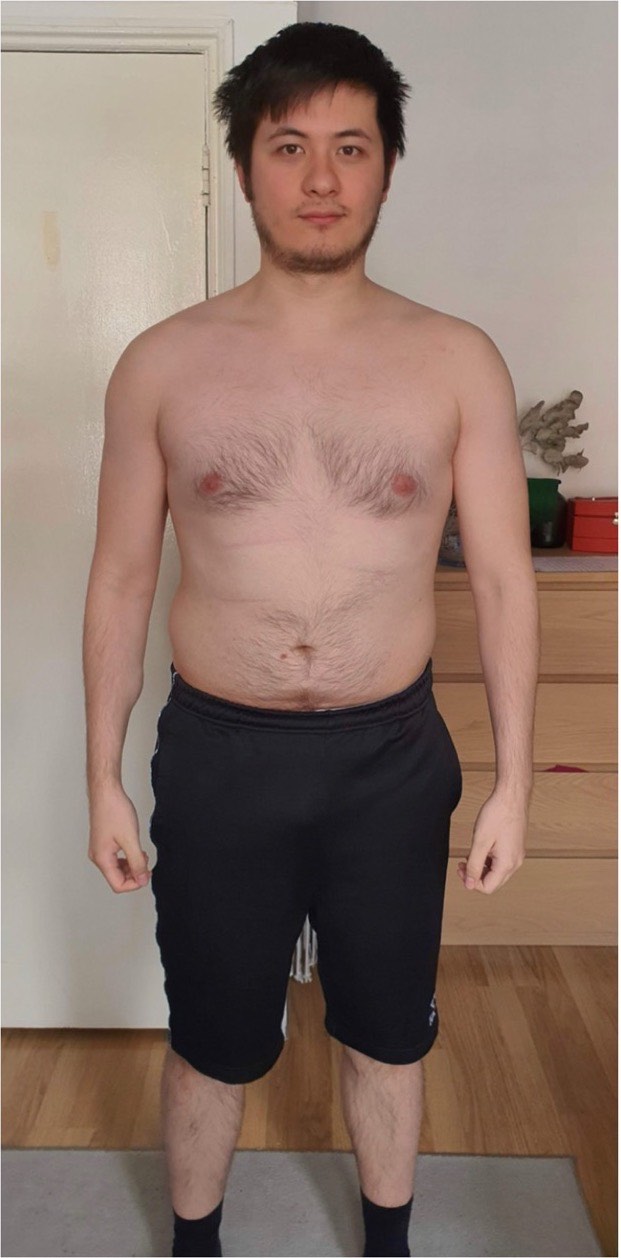 Ali: before and after transformation with Strategic Gains