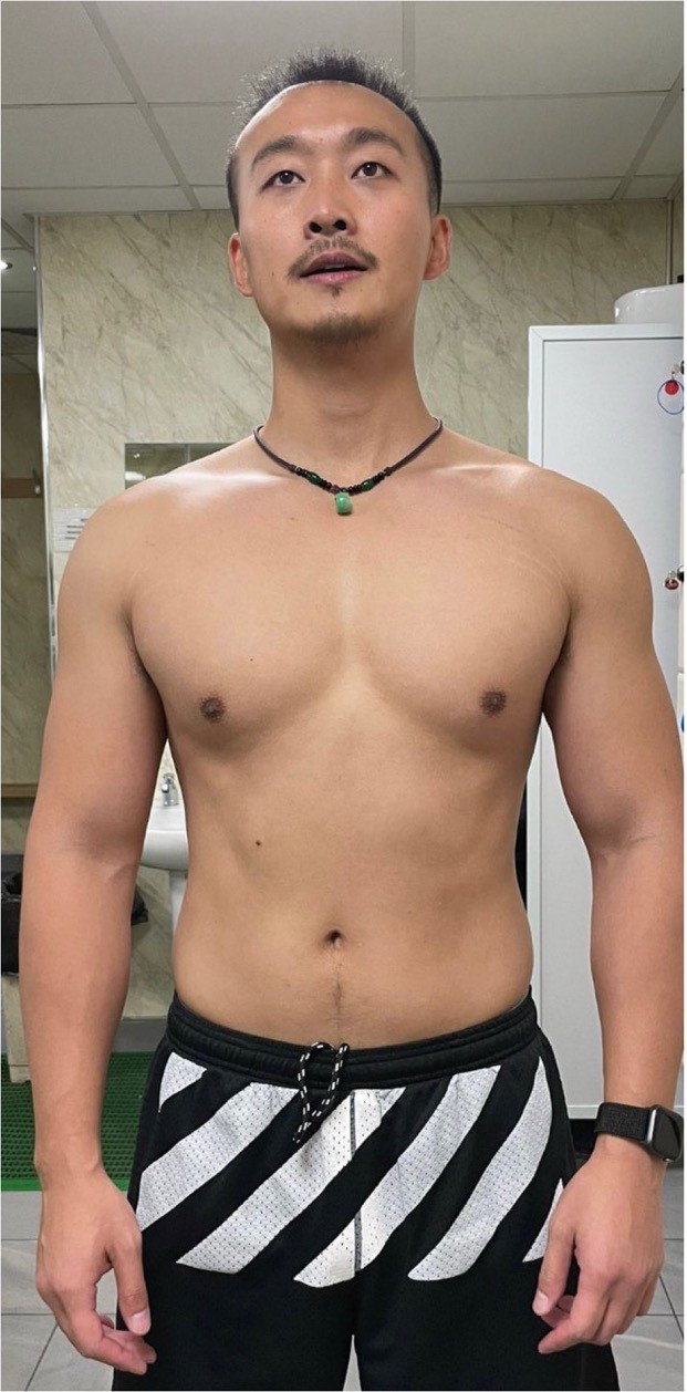 Eazy: before and after transformation with Strategic Gains