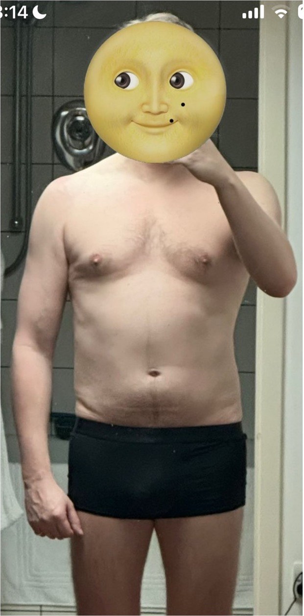 James: before and after transformation with Strategic Gains