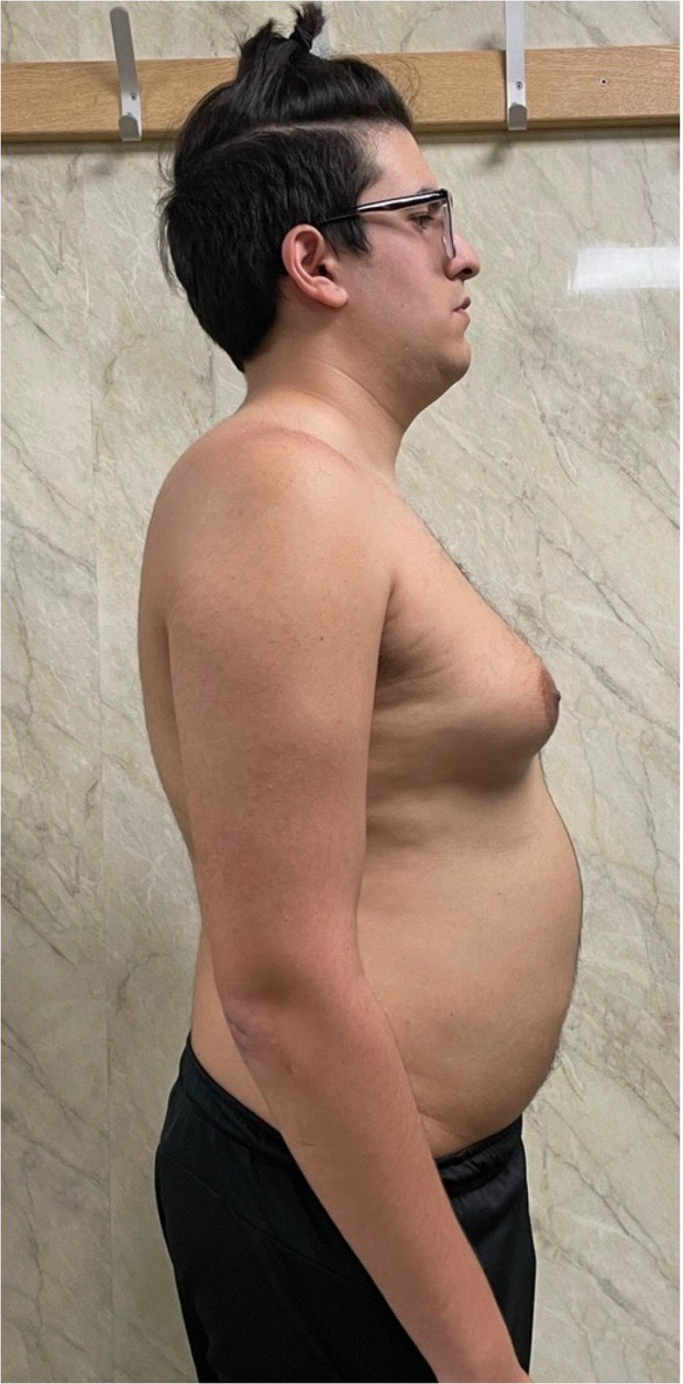 Serds: before and after transformation with Strategic Gains