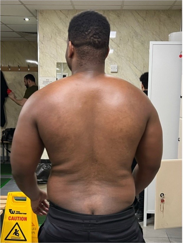 Simon: before and after transformation with Strategic Gains